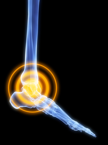 Sussex Foot Centre xrayed foot with highlight on ankle in orange Sussex Foot Centre xrayed foot with highlight