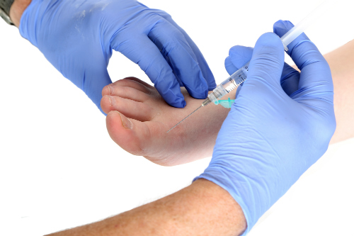 Cortisone Foot injection