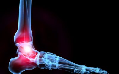 X-ray vs. Ultrasound For Diagnosing Pain