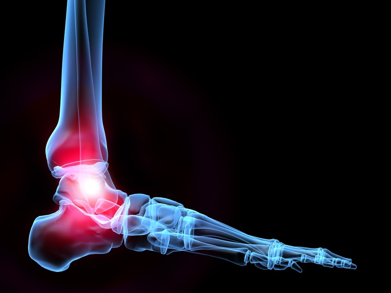 X-ray vs. Ultrasound For Diagnosing Pain