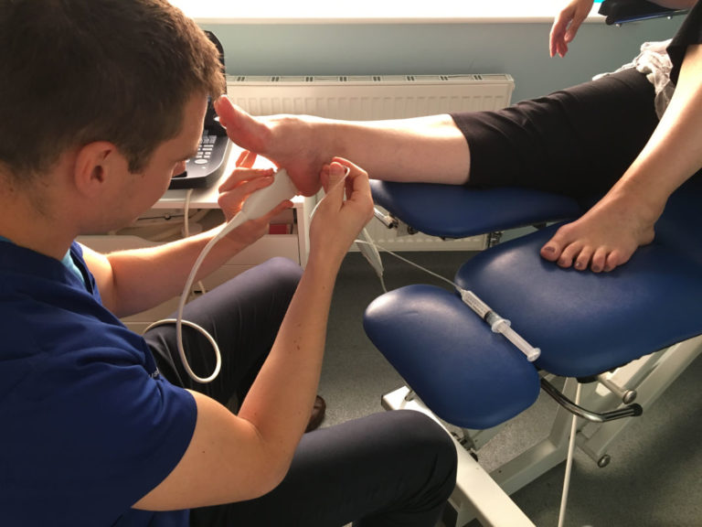 Plantar Fasciitis Ultrasound Sussex Foot Centre