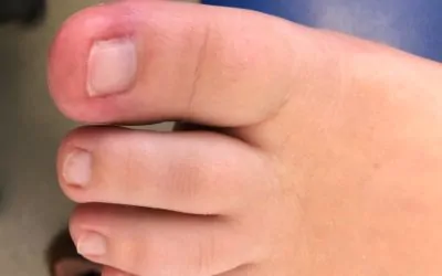 What Your Nails Can Tell You About Your Health