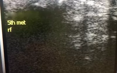 Diagnostic Ultrasound at the Sussex Foot Centre