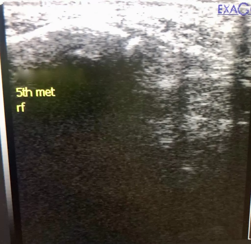 Diagnostic ultrasound